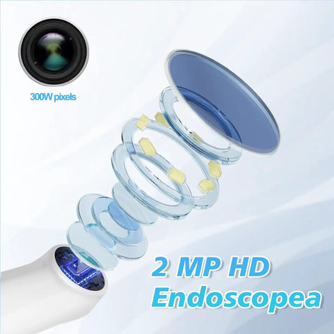 Oral Endoscope With 1920P HD Camera And 8 Handy LED Lights, 70 Degree Rotatable Angle For Close Up Teeth, At Home Dental Check Camera For Android And iOS, Easy Phone Recording And Clear Dental View In Purple, 2 MP HD lens