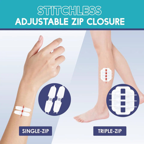 Wound Closure Strips Kit With Butterfly Bandages And Quick Clot Suture 32 Pcs Emergency First Aid Grab And Go Kit applied on arm and leg