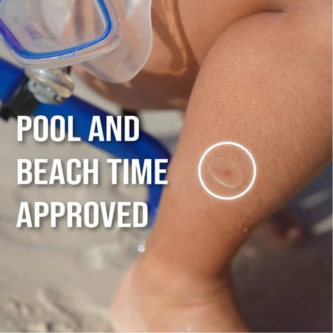 Mosquito Bite Itch Relief Patch For Kids All Natural With Aloe And Witch Hazel, shown on child's leg at beach