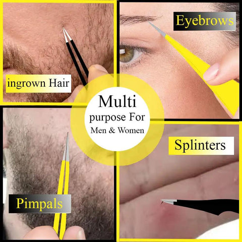 Ultra Precise Pointed Tweezers For Ingrown Hair Removal shown removing ingrown hair, splinters, pimples; multipurpose for men and women.