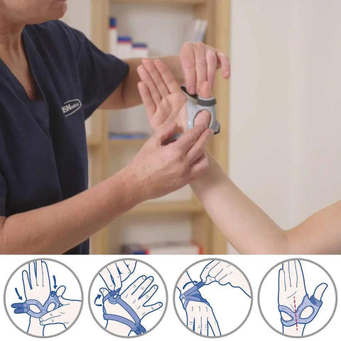 A person fitting a Rhizo Forte Thumb Brace For Right Hand Gray Large on a patient’s hand, showing adjustable aluminum core details.