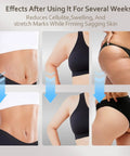 Before and after results using a 4 In 1 Lymphatic Drainage Massager For Whole Body With Microcurrent Red Light Heat And Vibration Anti Cellulite Fascia Tool.
