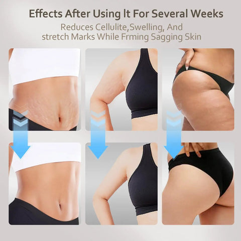 Before and after results using a 4 In 1 Lymphatic Drainage Massager For Whole Body With Microcurrent Red Light Heat And Vibration Anti Cellulite Fascia Tool.