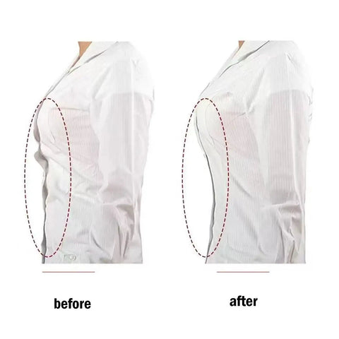 Before and after image of shirt with and without Clear Snap Buttons Set 100 Packs Four Sizes 7mm 10mm 15mm 18mm Invisible Sew On.