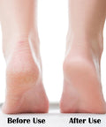 Before and after use of Glass Foot File With Fine Grinding Points For Dead Skin Removal And Calluses, Portable Pedicure Tool For Wet Or Dry Feet.