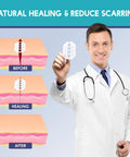Illustration showing doctor holding Wound Closure Strips Kit with Butterfly Bandages for natural healing and scar reduction.
