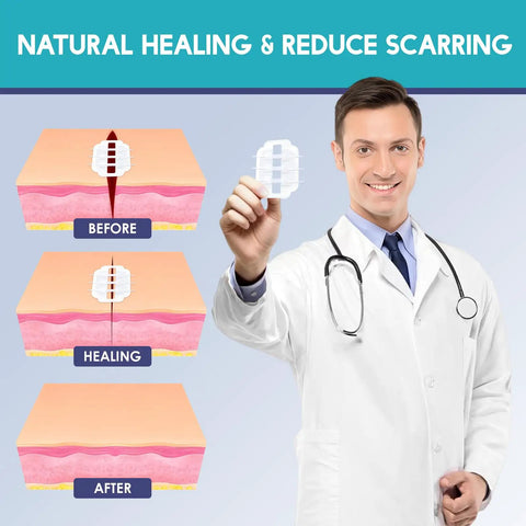 Illustration showing doctor holding Wound Closure Strips Kit with Butterfly Bandages for natural healing and scar reduction.