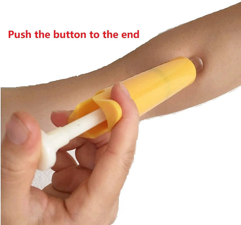 Go To Bee Sting And Snake Bite Venom Extractor Kit With Vacuum Suction Pump for first aid use shown on arm.