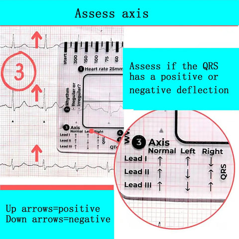 3 Pack ECG Seven Step Ruler Set, Portable Transparent PVC Calipers for ECG analysis with clear reference points for EKG interpretation.