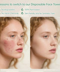 MATERN'ELLA disposable face towels: two-panel side-by-side before-and-after facial cleansing showing clearer skin