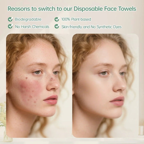 MATERN'ELLA disposable face towels: two-panel side-by-side before-and-after facial cleansing showing clearer skin