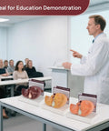 Hella Realistic Silicone Liver Anatomy Set Featuring Three Straight Up Life Size Medical Teaching Models displayed in lecture.