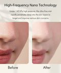 Before and after skin close-up using Facial Oxygen Spray Machine High Pressure Nano Steamer With 0.3mm Nozzle