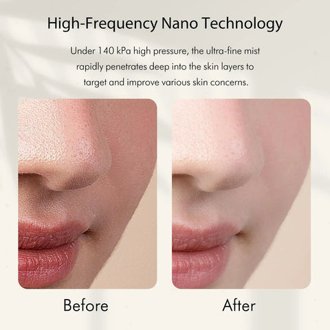 Before and after skin close-up using Facial Oxygen Spray Machine High Pressure Nano Steamer With 0.3mm Nozzle