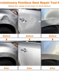 135 Piece Paintless Dent Repair Kit For Cars With T Bar Puller Bridge Puller Golden Lifter And More DIY Car Dent Remover For Door Dings Hail Damage And Body Creases Learn To Fix Scratches At Home With This All In One Auto Body Repair Set. before and after car dent repair panels