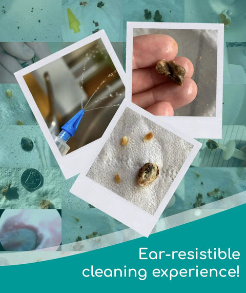 Easy Water Rinse Ear Wax Removal Kit With 3 Quad Stream Tips showing water spray and removed wax pieces