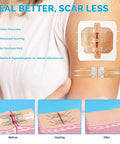 16 Pack Zip Stitches Wound Closure Kit With Butterfly Bandages shown on arm for painless stitchless healing