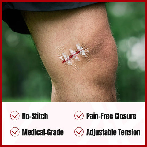 RHINO RESCUE Wound Closure Kit on knee; three butterfly bandages with clear adhesive clips, medical-grade.