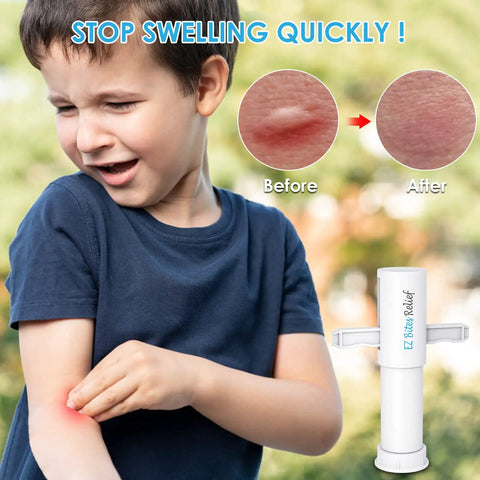 Two Pack Kid Friendly Bug Bite Relief Suction Tool For Kids And Adults Venom Extractor Sucker, white plastic, for itchy bite relief