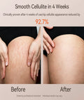 Before and after using 3-In-1 Body Sculpting Machine With Red Light Vacuum Suction And Microcurrent, smoother thigh skin.