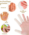Hand wearing Moisture Wicking Cotton Finger Cots And Toe Sleeves Set For Glove Comfort, showing comparison with skin conditions.