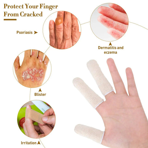 Hand wearing Moisture Wicking Cotton Finger Cots And Toe Sleeves Set For Glove Comfort, showing comparison with skin conditions.