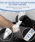 PELCAS LED Electric Toenail Grinder for Thick Toenails in use, removing dead skin and calluses with LED light.