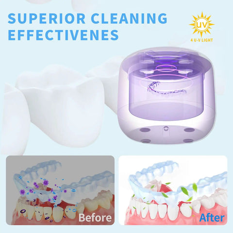 Ultrasonic Retainer Cleaner For Aligners And Mouth Guards, 45KHz Deep Cleaning, 360 Degree Coverage, 300ml Capacity, Two Modes.