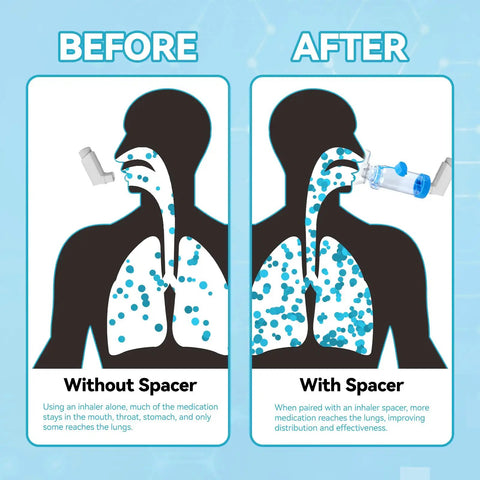 Diagram shows 'before and after' of using Adult Inhaler Spacer With Soft Silicone Mask For Easy Breathing At Home Or On The Go
