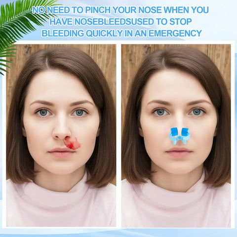 Woman using Nosebleed Quick Stop Clip Set With 16 Plastic Foam Clips Handy Storage Box And Pouches Ready For Home Or Grab And Go Emergency Nosebleeds.