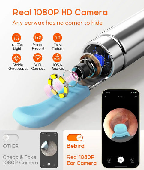 Ear Wax Removal Tool With Camera Ear Scope 1080P 6 LED Lights Replacement Tips Wide Angle Ear Canal Cleaner close-up view.