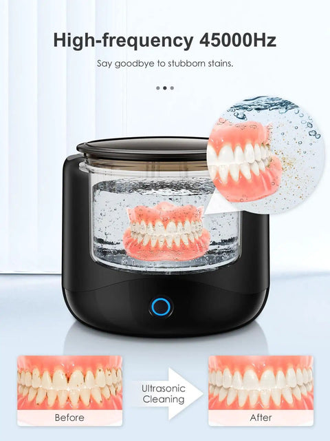 Deep Clean Ultrasonic Retainer Cleaner All In One 45kHz Power For Dentures Mouth Guards Aligners Braces Toothbrush Heads And Jewelry 230ml Cleaning Pod With Three Modes And Digital Timer showing dentures being cleaned with before and after results