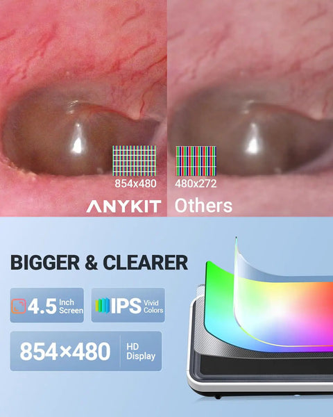Digital Ear Otoscope With Gyroscope And 4.5 Inch Screen, 3.9mm Inspection Camera With Six LED Lights For Easy Ear Wax Removal, 32GB Card, Snap Photos And Record Videos, Your Own Ear Doctor At Home Checkup showing 4.5-inch HD IPS display