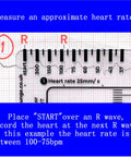 Triple Pack ECG 7 Step Ruler Set For ECG EKG Interpretation, Transparent Plastic Calipers Measuring Tool in use on EKG tracing