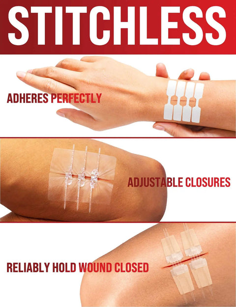 Butterfly Bandages Wound Closure Strips Kit 24 Pack Featuring Three Types for pain-free laceration care on arm.