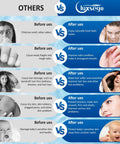 Comparison between effects of using other shower heads vs Luxsego shower set for skin and hair health improvement.