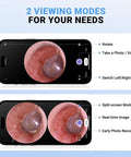 Wireless Digital Otoscope With Built In Screen And Lights For Easy At Home Ear Health Exams, Real Time Viewing, Portable Self Care Tool For Clear Ear Canal Inspections And Quick Self Diagnosis. 2 viewing modes shown