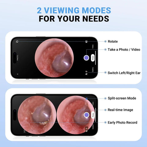 Wireless Digital Otoscope With Built In Screen And Lights For Easy At Home Ear Health Exams, Real Time Viewing, Portable Self Care Tool For Clear Ear Canal Inspections And Quick Self Diagnosis. 2 viewing modes shown