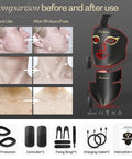 Anti Aging Red Light Therapy Mask For Face And Neck With 850Nm Near Infrared Plus 630Nm Red Led Diodes before and after comparison