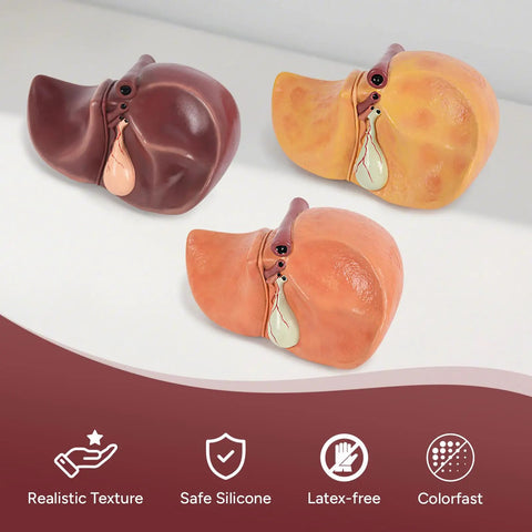 Hella Realistic Silicone Liver Anatomy Set featuring three life-size liver models in normal, fatty, and alcoholic versions.