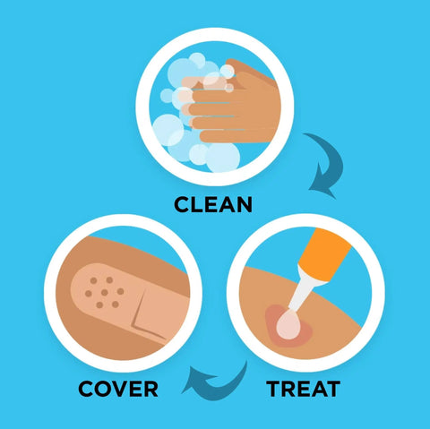 Illustration of steps: wash hands, apply treatment, cover with Fun Mickey Mouse Themed Bandage Set For Kids With 20 Count Of Assorted Adhesive Strips