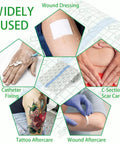 Application uses for Aftercare Bandage Roll For Tattoos 8 Inch By 2 Yard Waterproof Transparent Film in various wound scenarios