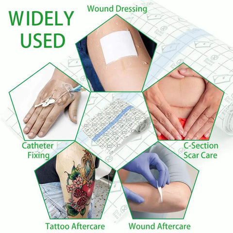 Application uses for Aftercare Bandage Roll For Tattoos 8 Inch By 2 Yard Waterproof Transparent Film in various wound scenarios
