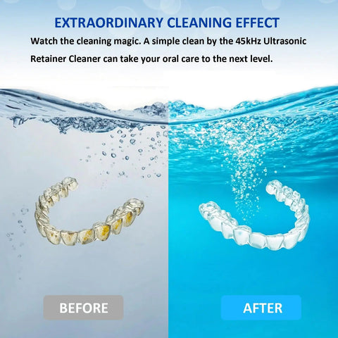 Three In One Ultrasonic Retainer Cleaner With UV Sanitizer And Fast Drying Fan For Dentures Aligners Mouth Guards Night Guards And Jewelry Deep Clean Odor Busting And Quick Dry, before-after aligner cleaning
