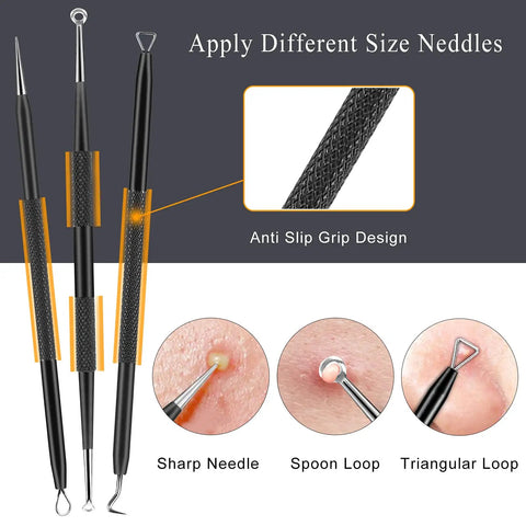 Three stainless steel tools from 6 Piece Pimple Popper Tool Kit Blackhead Remover Comedone Extractor Set With Metal Case and skin close-ups.