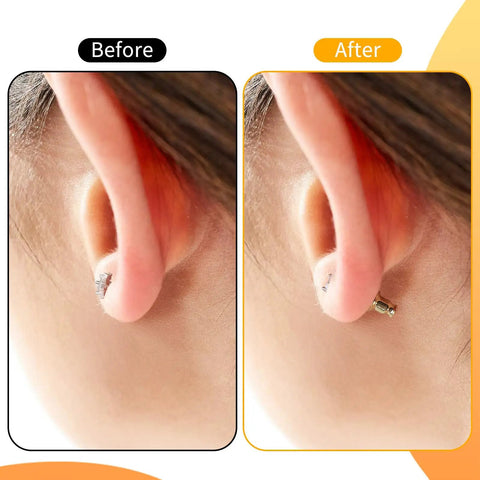Before and after use of 8 Pack Earring Lifters Backings For Droopy Ears Large Stud Back Replacements showing secure fit
