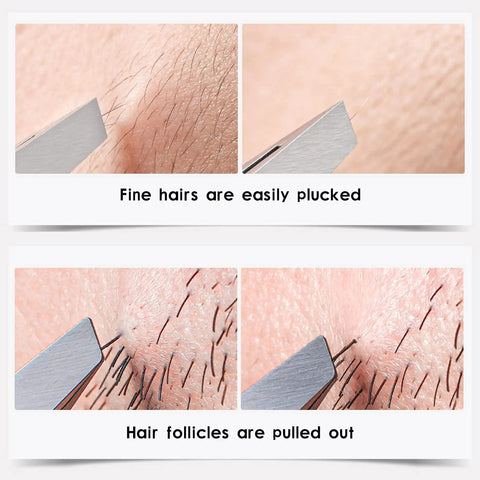 Professional Stainless Steel Slant Tweezers Set 2 Pack Precision Eyebrow Tweezers for Facial Hair Ingrown Hair and Blackhead Removal plucks fine hairs