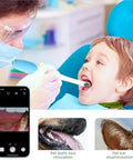 Oral Endoscope With 1920P HD Camera And 8 Handy LED Lights, 70 Degree Rotatable Angle For Close Up Teeth, At Home Dental Check Camera For Android And iOS, Easy Phone Recording And Clear Dental View In Purple used on child mouth exam