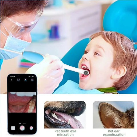 Oral Endoscope With 1920P HD Camera And 8 Handy LED Lights, 70 Degree Rotatable Angle For Close Up Teeth, At Home Dental Check Camera For Android And iOS, Easy Phone Recording And Clear Dental View In Purple used on child mouth exam