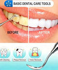 Pro At Home Dental Tools Set for teeth cleaning showing before and after results of plaque and tartar removal.
